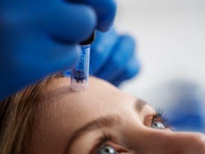 NUR Kosmetik freiburg microneedling